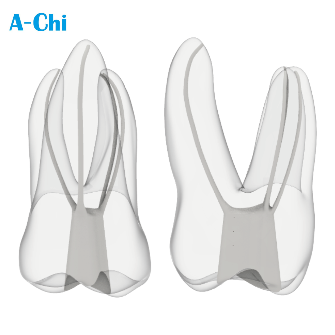 Maxillary Molar
